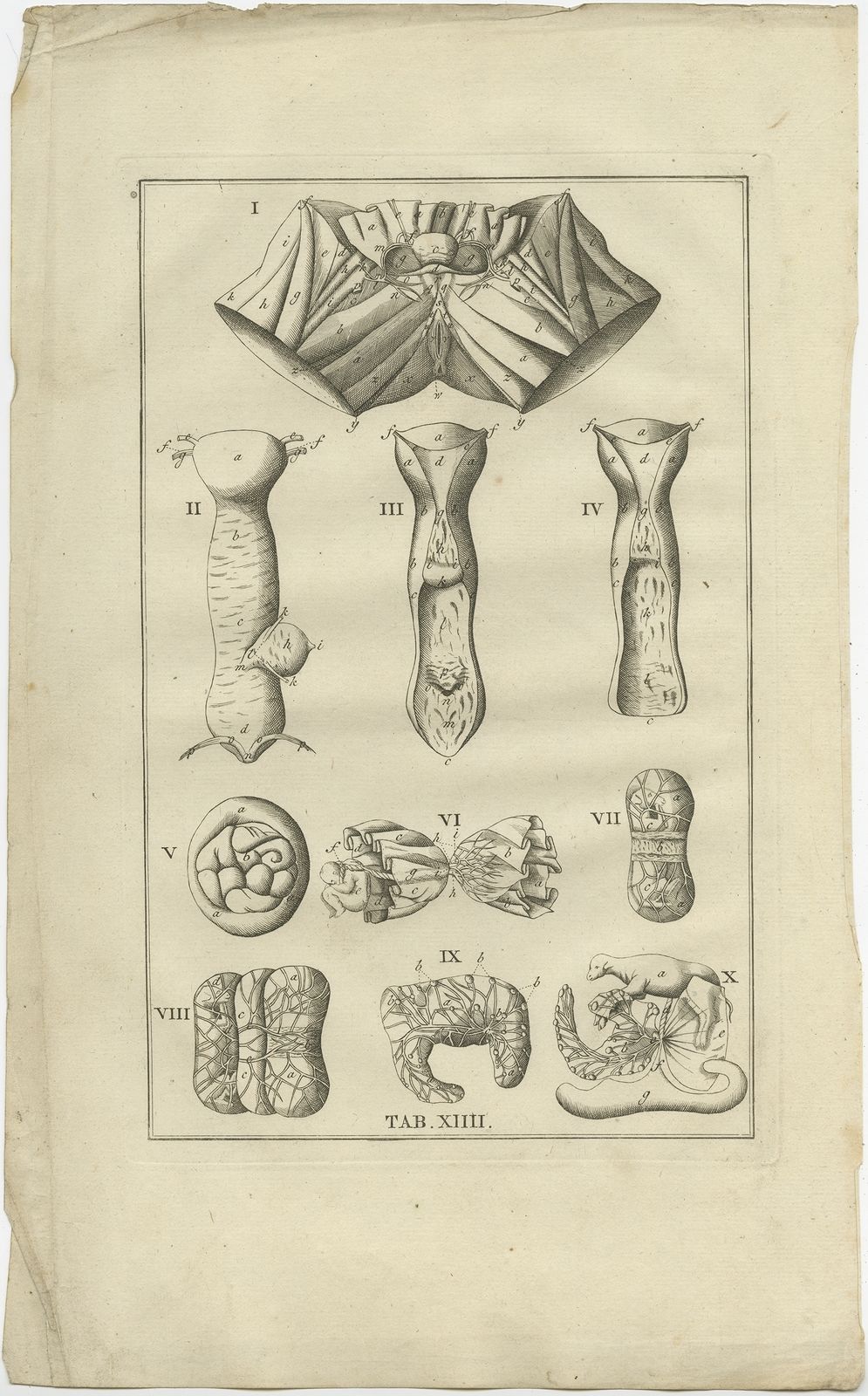 Pl. 14 Antique Anatomy Print Of The Female Reproductive Organs By Elwe (1798)