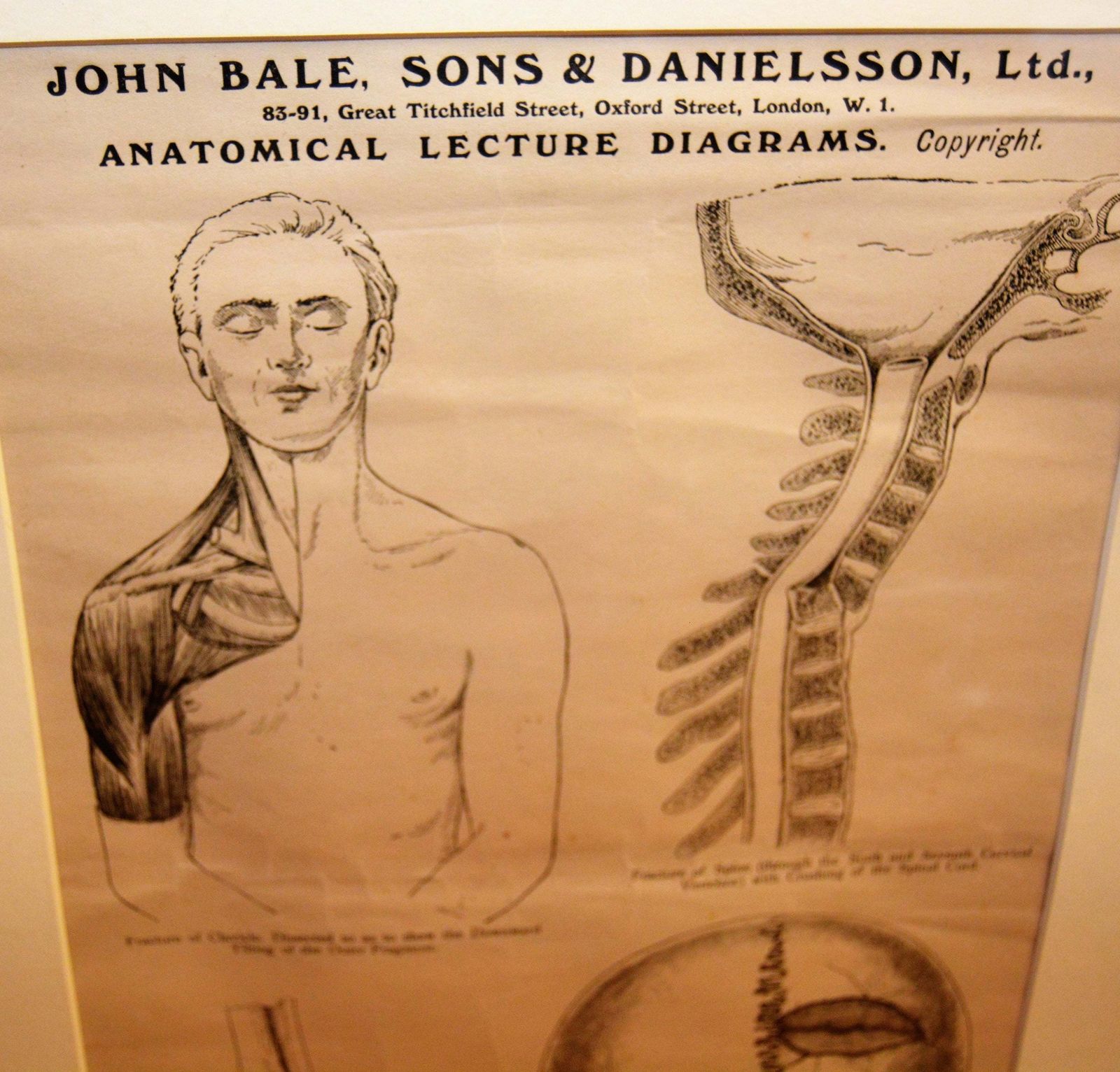 Anatomical Posters Charts Medical Vintage Macabre Wall Art Dentist Industrial Tattoo Mancave photo furniture