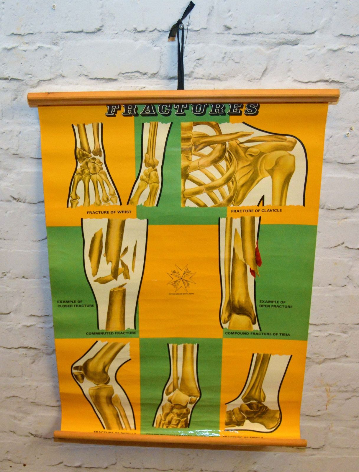 St. John Ambulance Medical Anatomical Chart Poster Wall Art Vintage Retro Antique Industrial Macabre Taxidermy