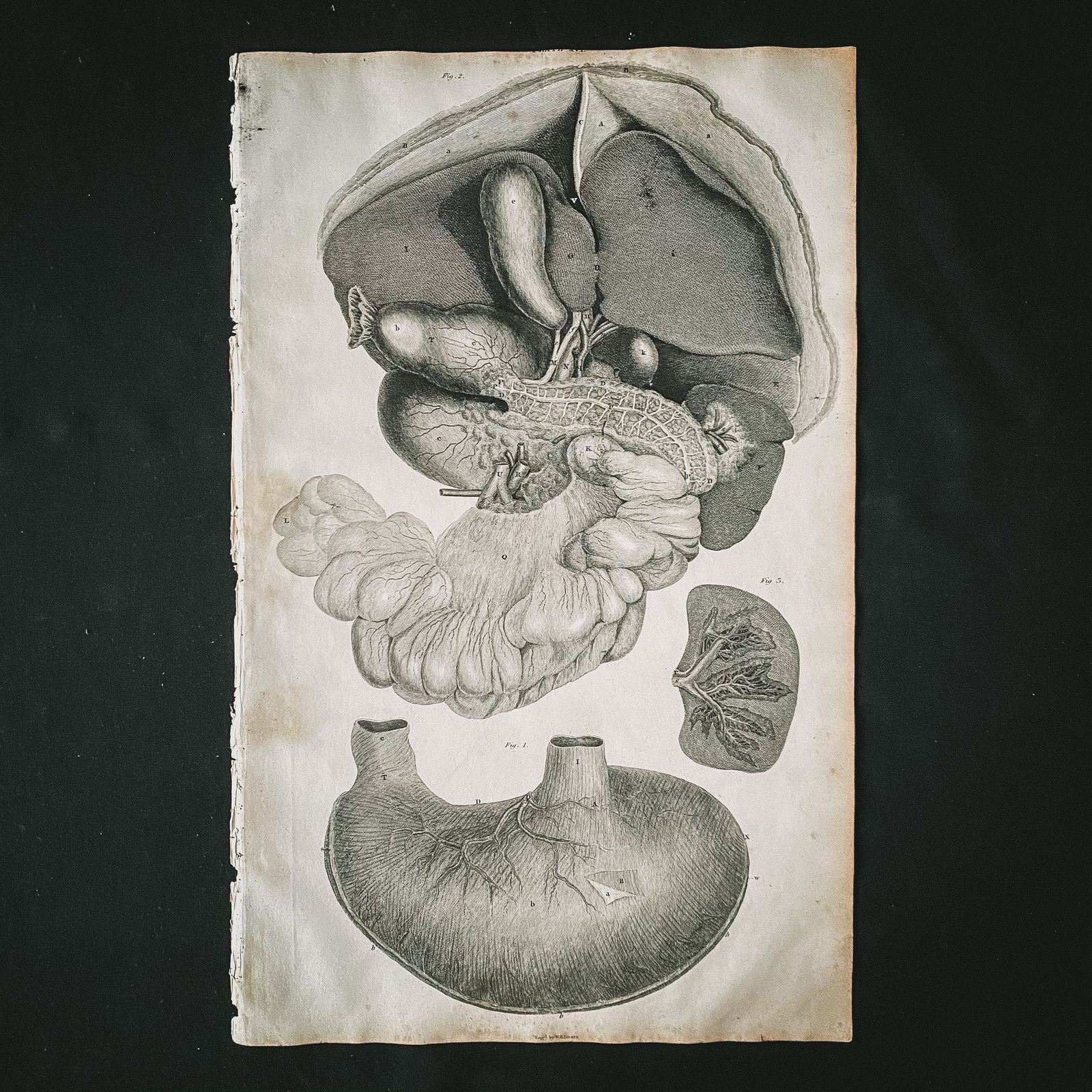 Anatomical Organs 1, Lizars 1824 'System Of Anatomical Plates' photo furniture