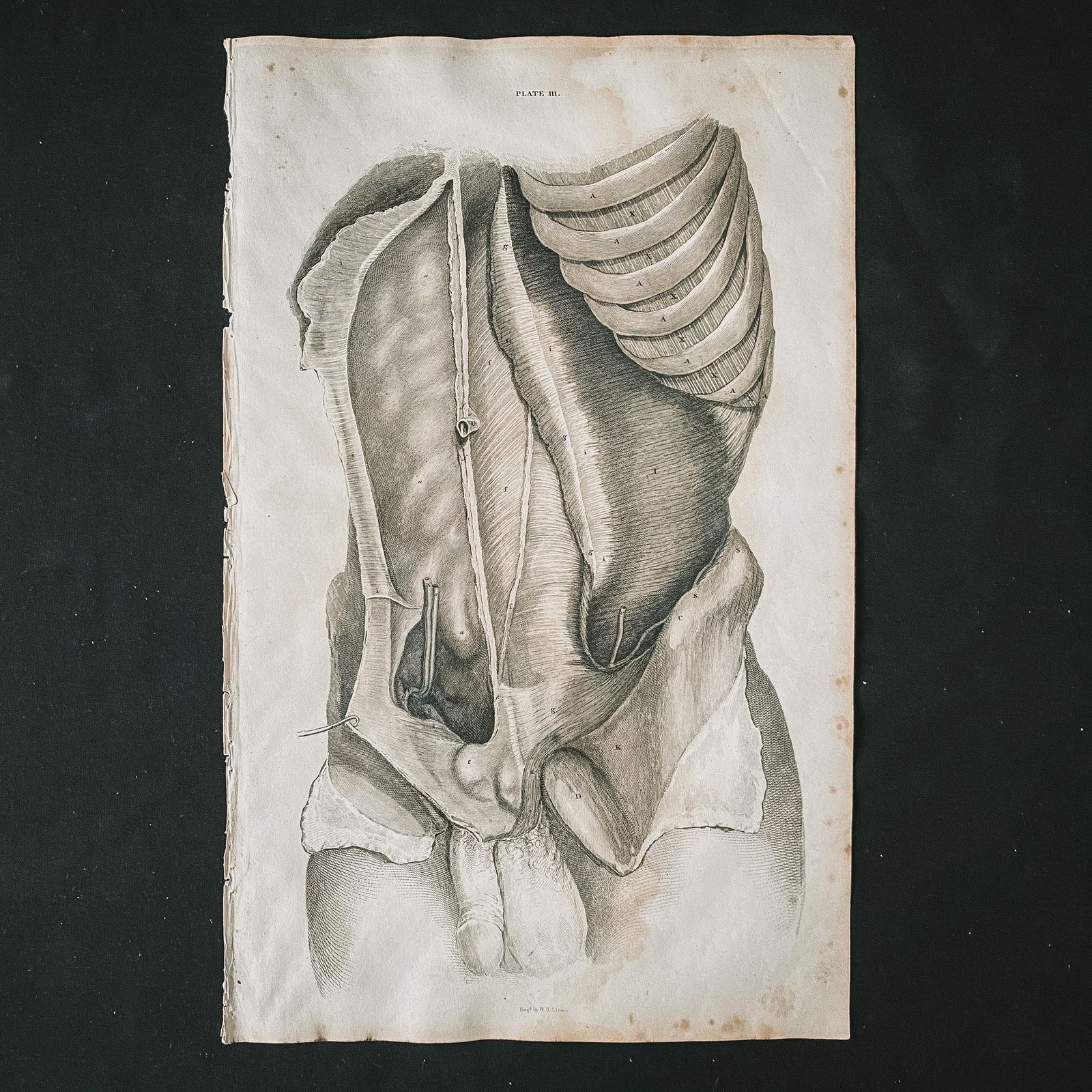 Anatomical Male Lower Body 1, Lizars 1824 'System Of Anatomical Plates' photo furniture