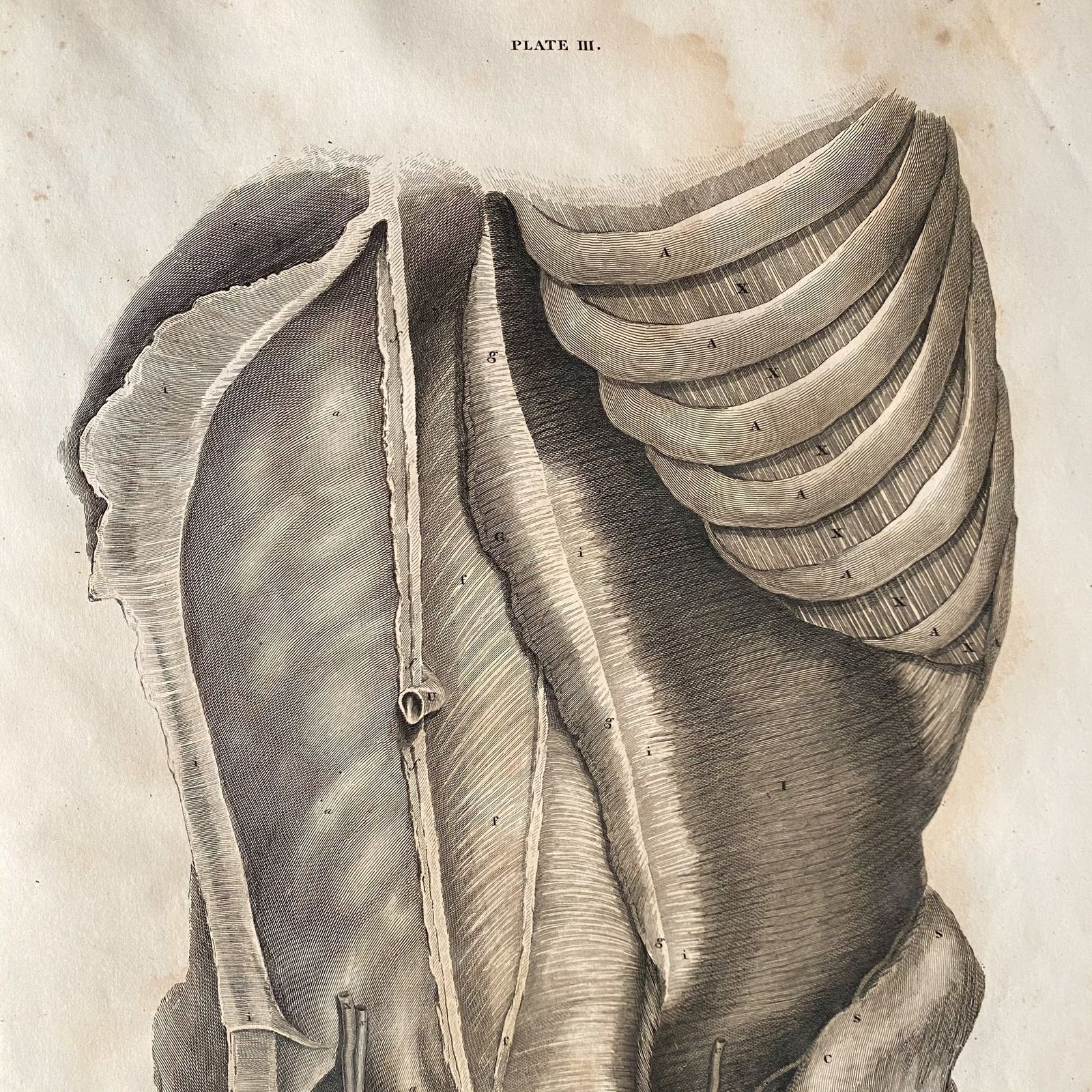 Anatomical Male Lower Body 1, Lizars 1824 'System Of Anatomical Plates' photo for sale