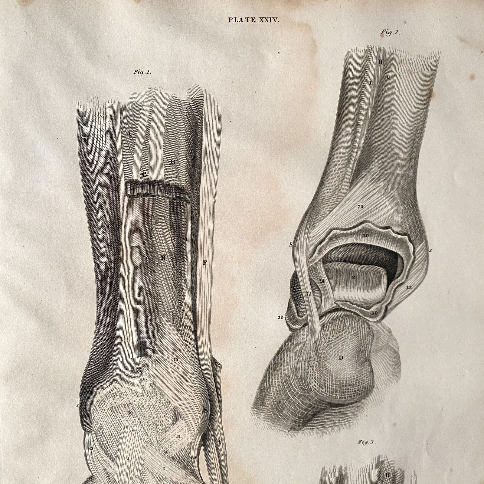 Anatomical Foot 1, Lizars 1824 'System Of Anatomical Plates' photo for sale
