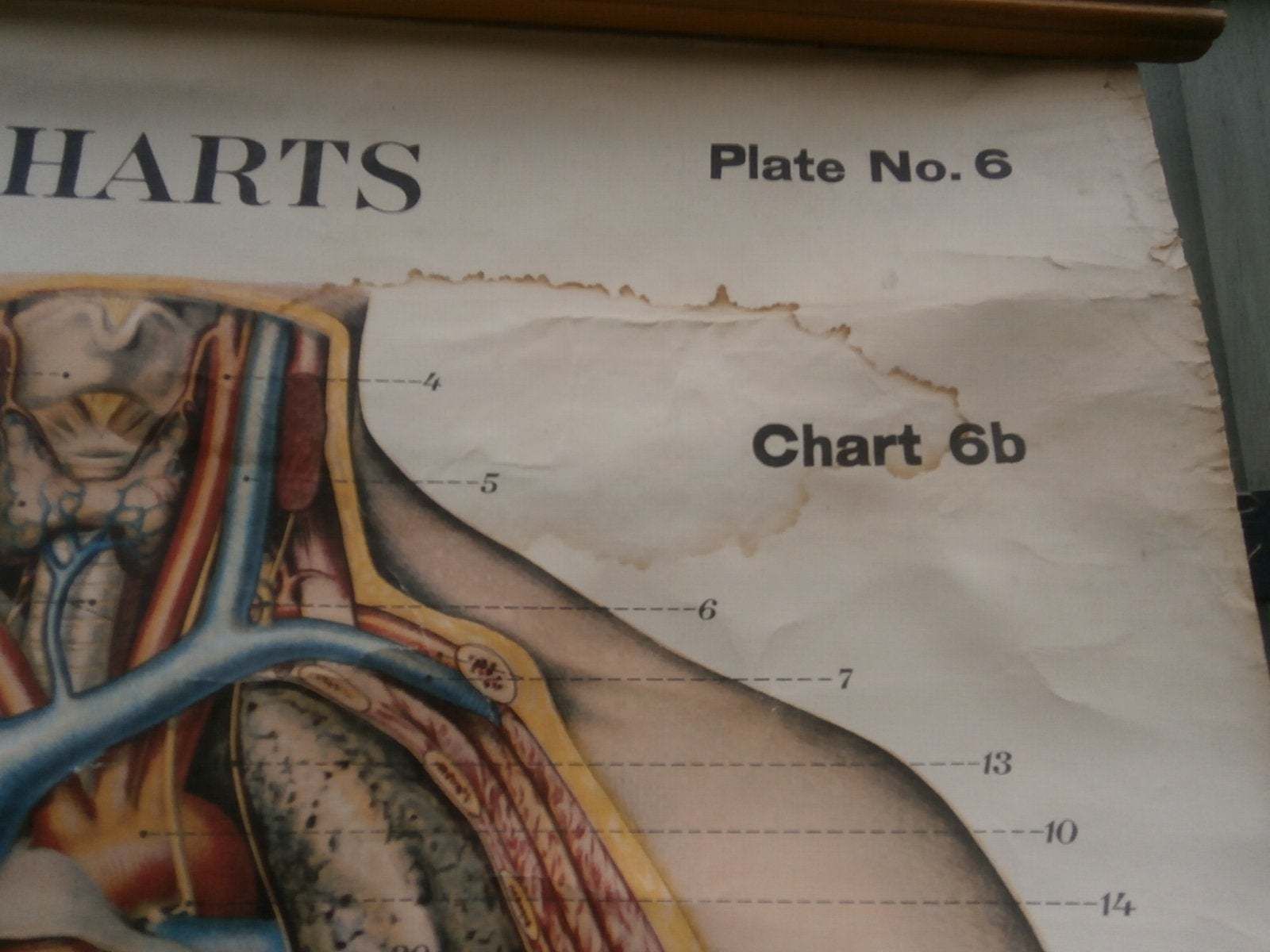 photo for sale Adam, Rouilly & Co, Large American Frohse Anatomical Chart No6 Chest And Abdomen, 1970s