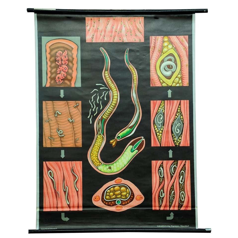 Jung Koch Quentell Rollable Poster Print Wall Chart Trichina