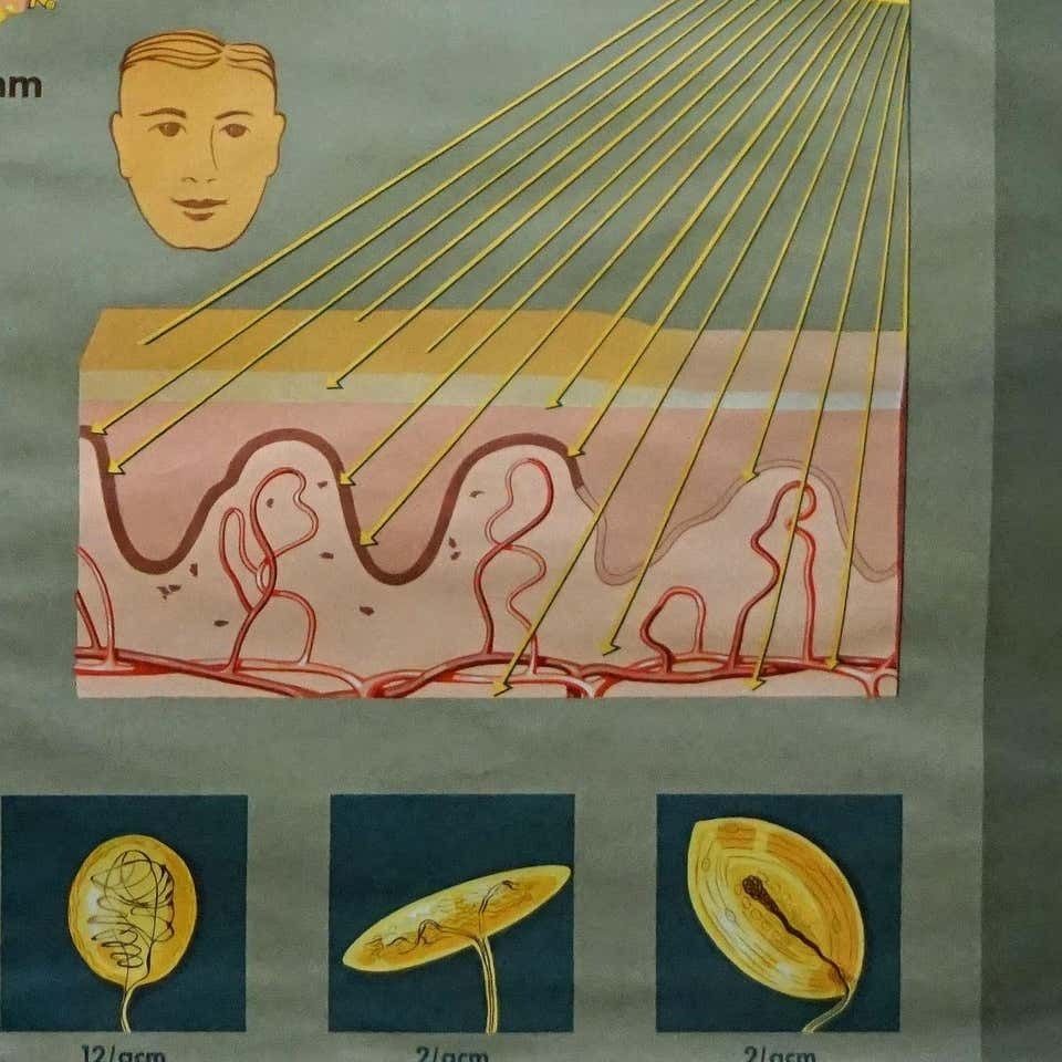 Hagemann Medical Rollable Poster Wall Chart Human Body Skin Cross Section photo 359.0
