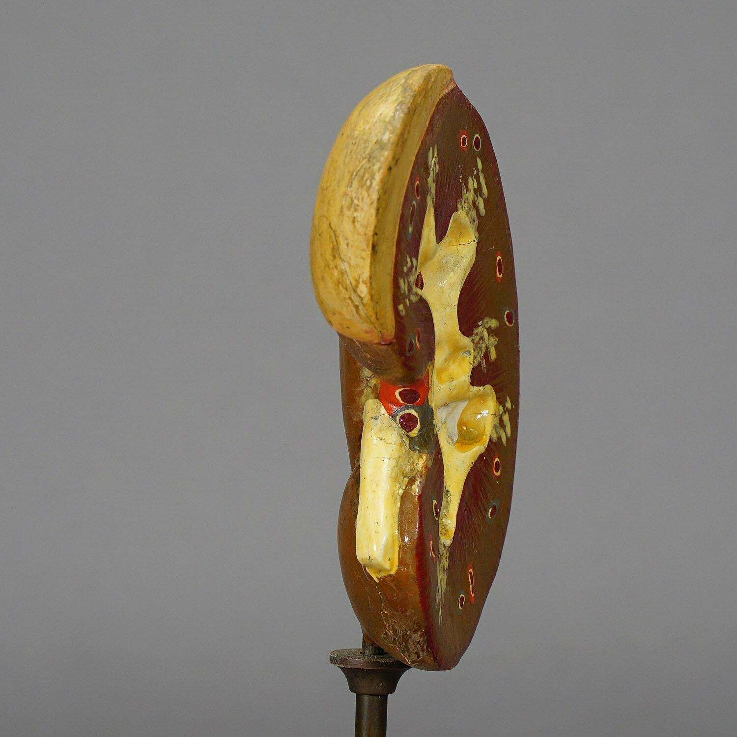 Antique Teaching Model Longitudinal Profile Of The Kidney, Ca. 1900 photo for sale