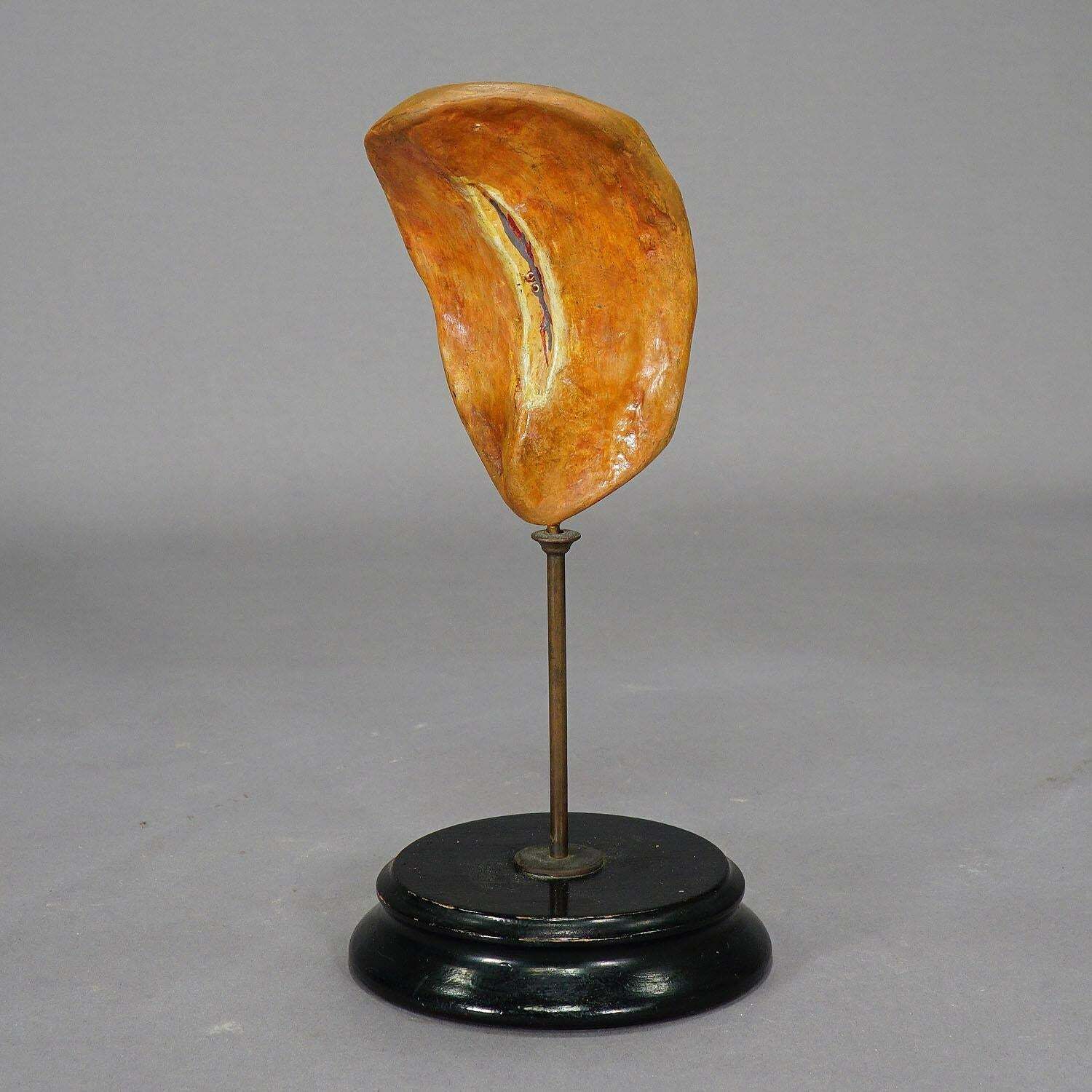 Antique Teaching Model Of The Adipose Spleen, Ca. 1900 photo Art