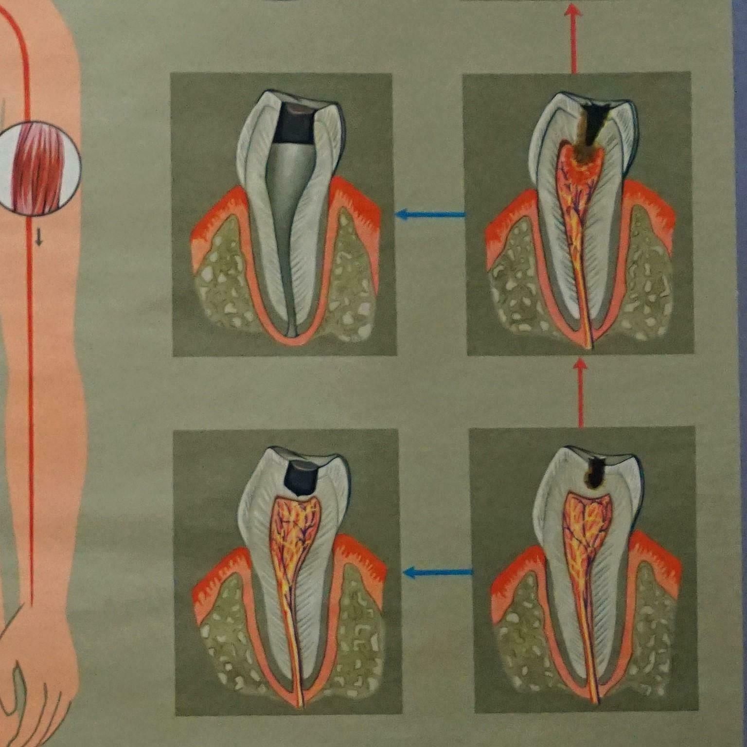 Human Body Poster Rollable Wall Chart Print Healthy Teeth Jaw Head photo buy