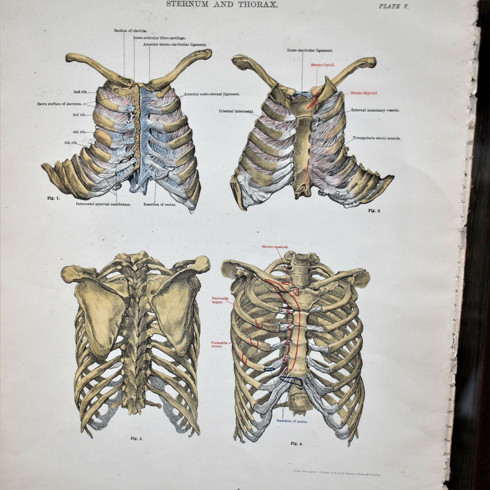 photo for sale Antique 1885 W & Ak Johnston Human Pelvis Thorax Plate Print Museum Frame Pair