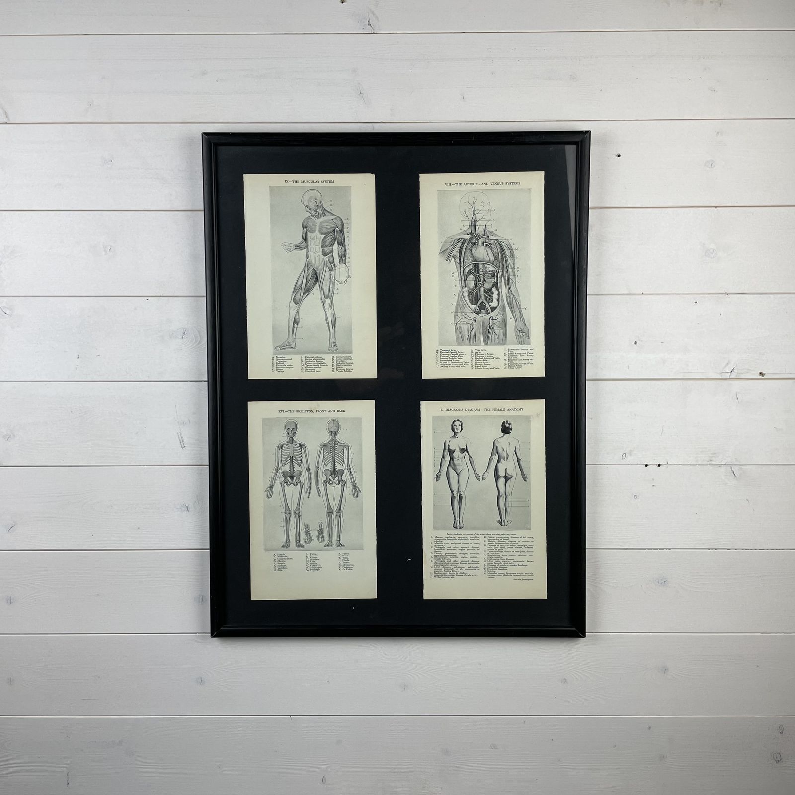 Framed Vintage Medical Anatomy Prints