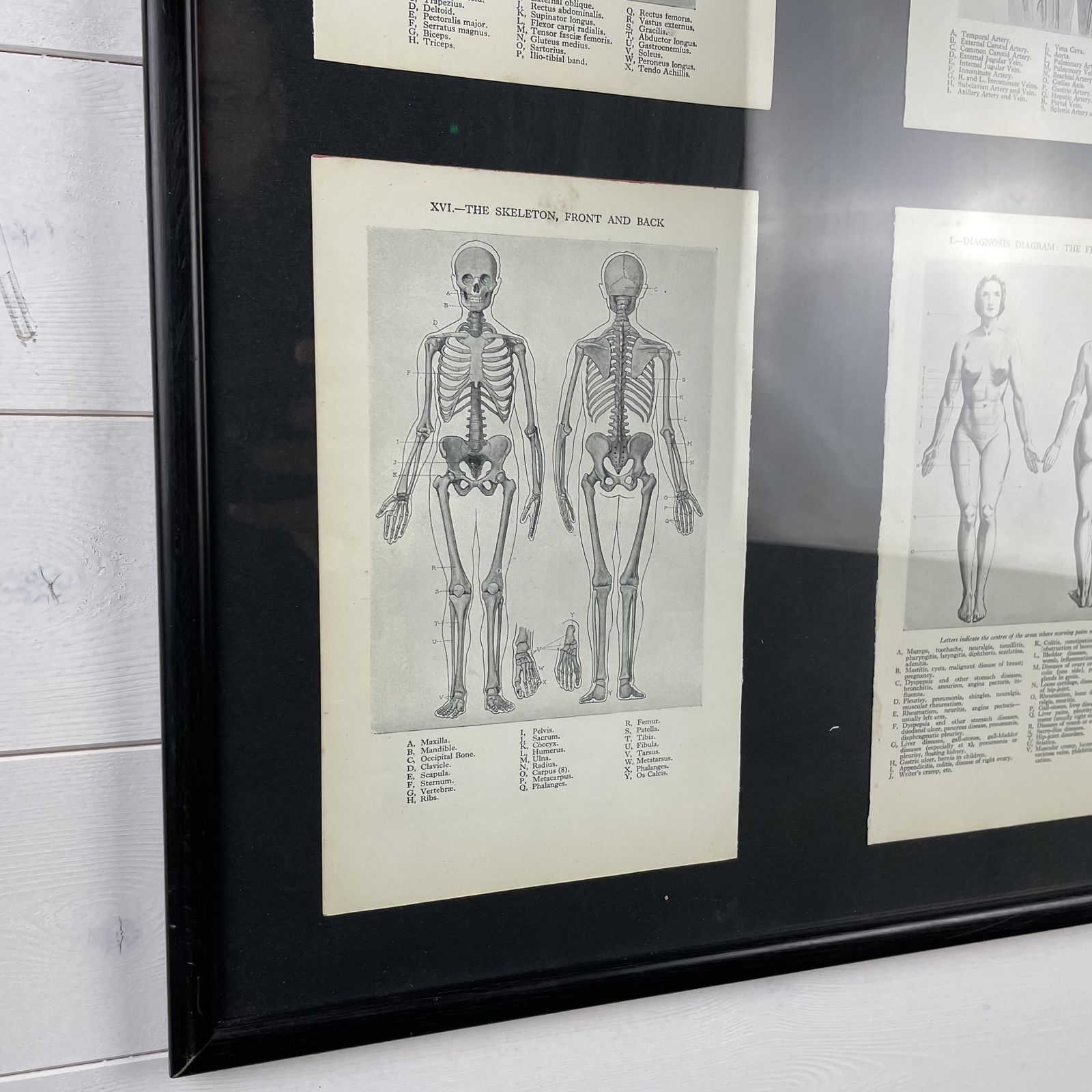 Framed Vintage Medical Anatomy Prints photo for sale