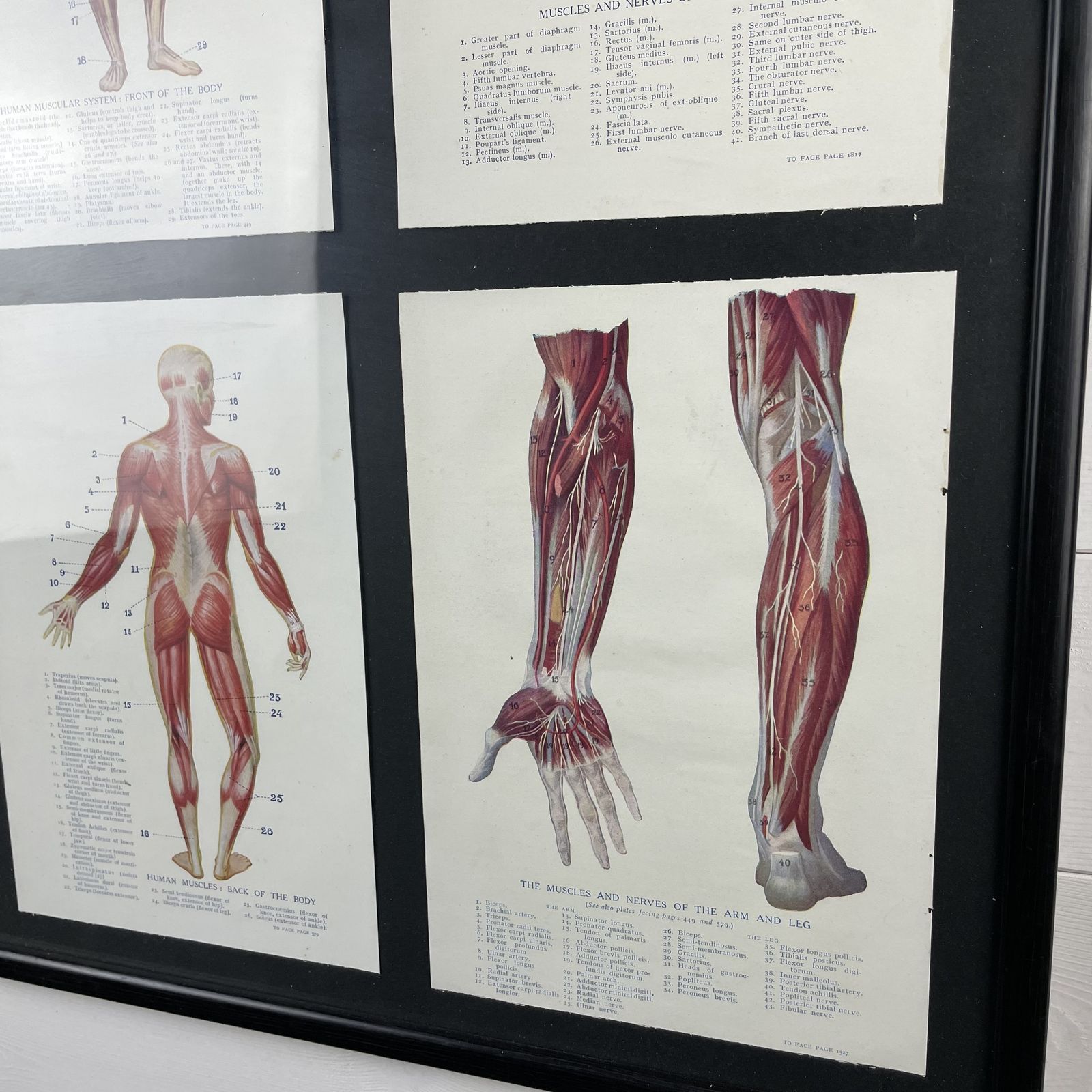 Vintage Framed Medical Anatomy Prints photo Art