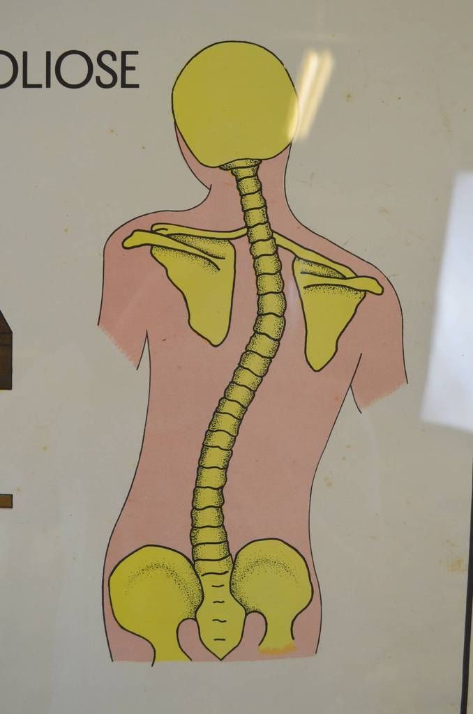 Mid Century French Medical Poster photo vinterior