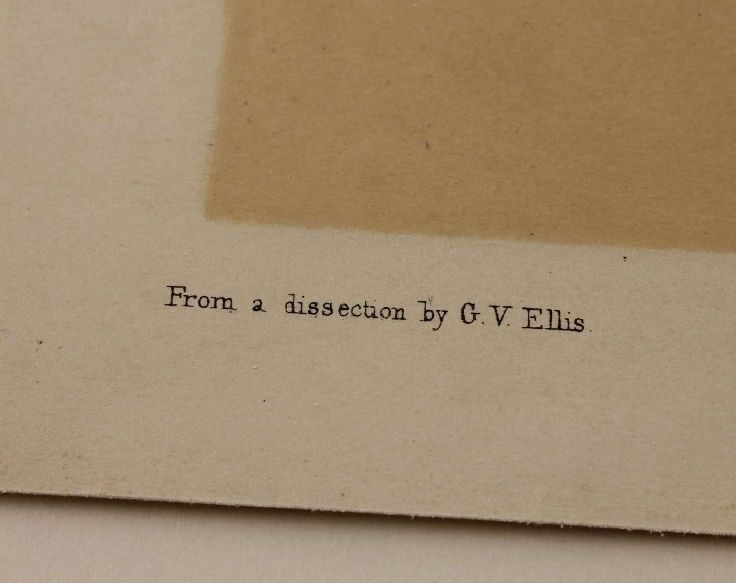 G Ellis 1864 Illustration Of Dissection The Face. Anatomy Lithograph photo buy