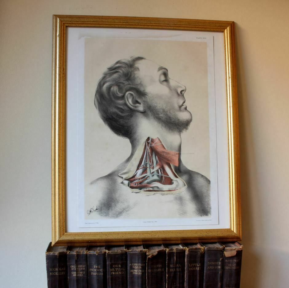 Original G Ellis Anatomy Lithograph Illustration Of Neck Dissection. 1864. photo furniture
