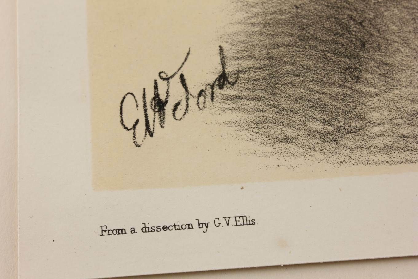 Original G Ellis Anatomy Lithograph Illustration Of Neck Dissection. 1864. photo vinterior