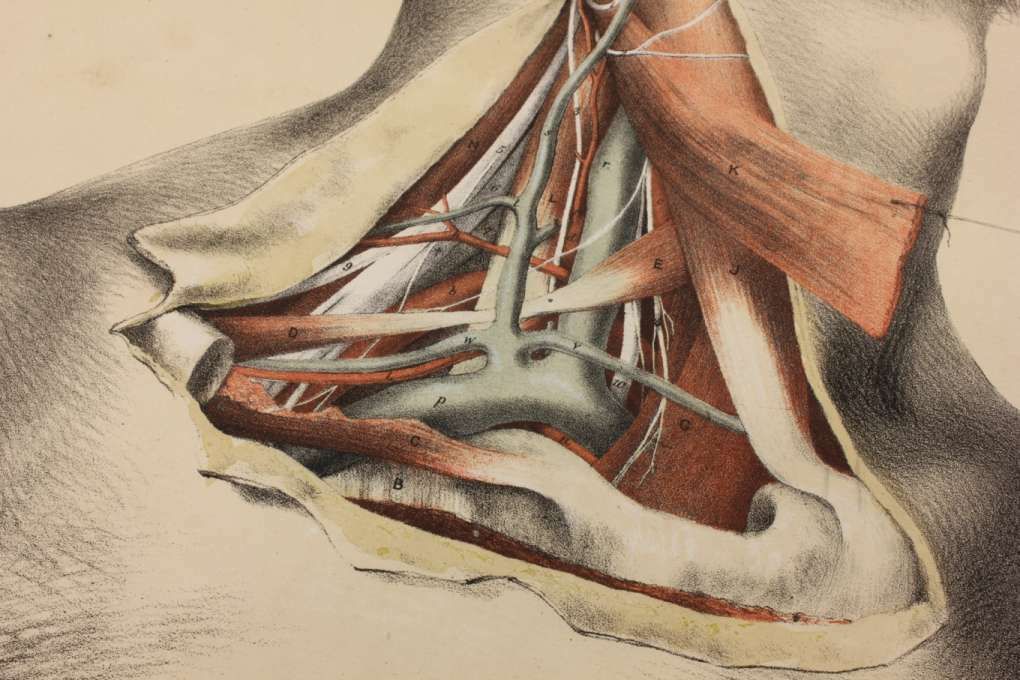 photo furniture Original G Ellis Anatomy Lithograph Illustration Of Neck Dissection. 1864.