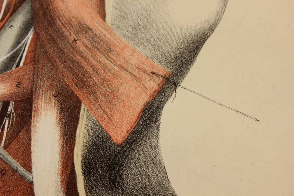 photo for sale Original G Ellis Anatomy Lithograph Illustration Of Neck Dissection. 1864.