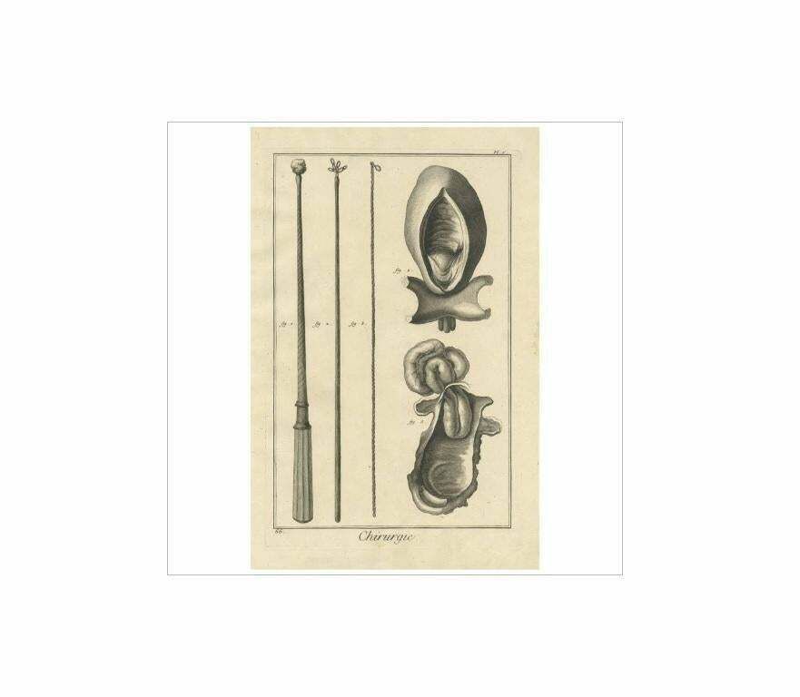 Antique Medical Print 'Pl. V' By D. Diderot, Circa 1760 photo for sale