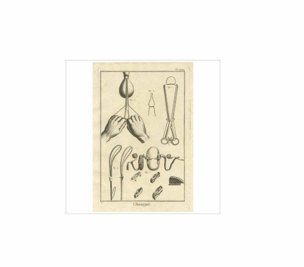 Antique Medical Print Pl. Xxxiv' By D. Diderot Circa 1760 photo for sale