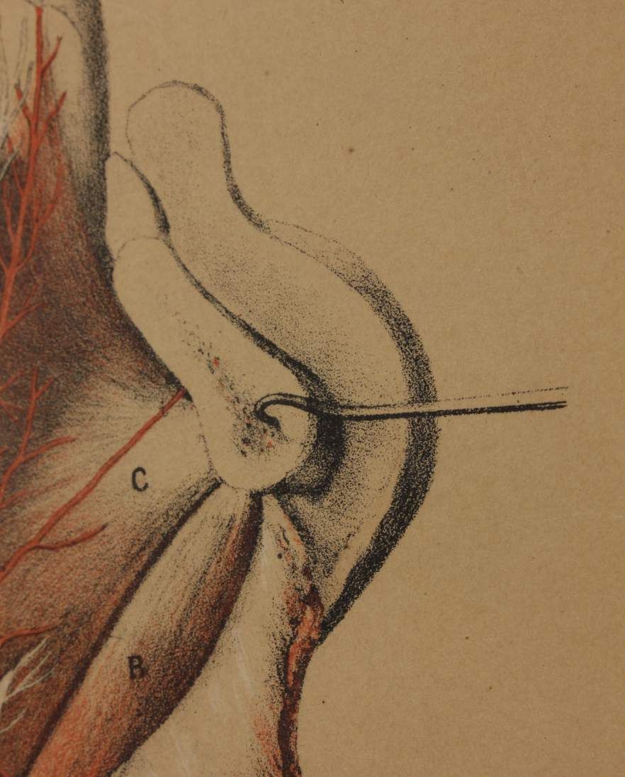 Illustration Of Dissection Of Throat. Anatomy Lithograph. G Ellis 1864. photo vintage