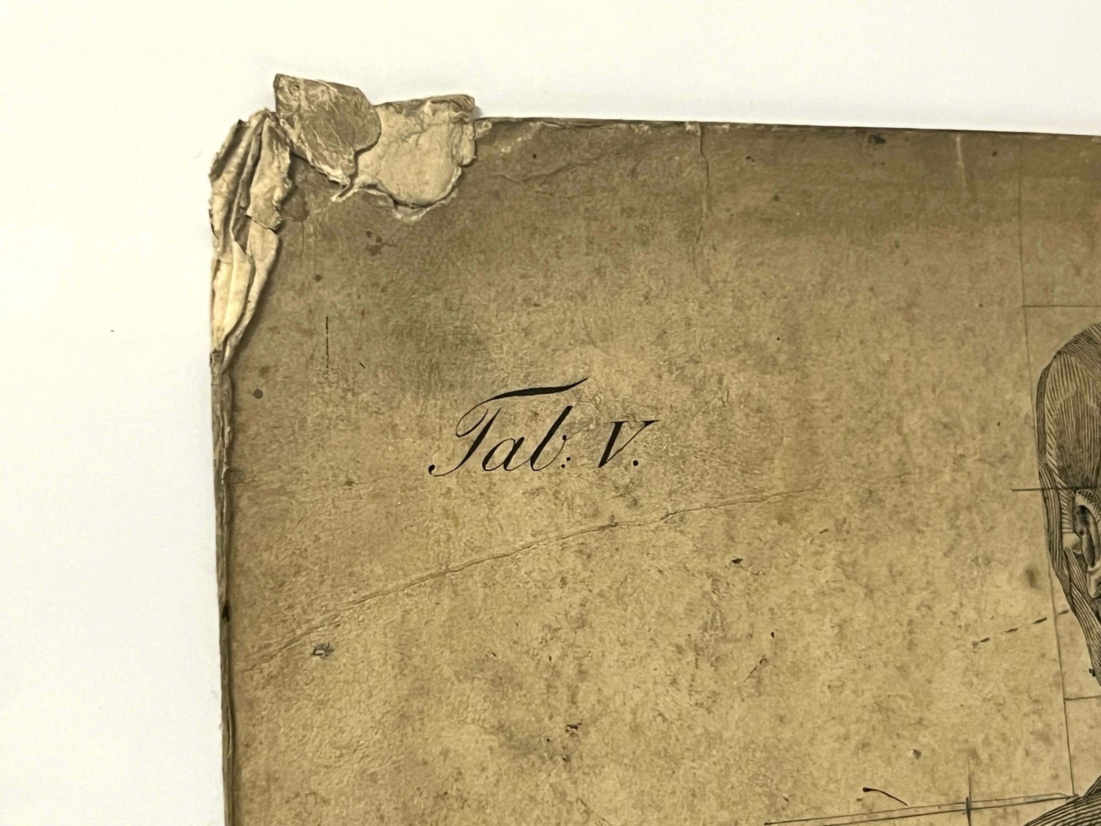 DR Munz Fecit, A 19th Century Anatomical Etching photo buy