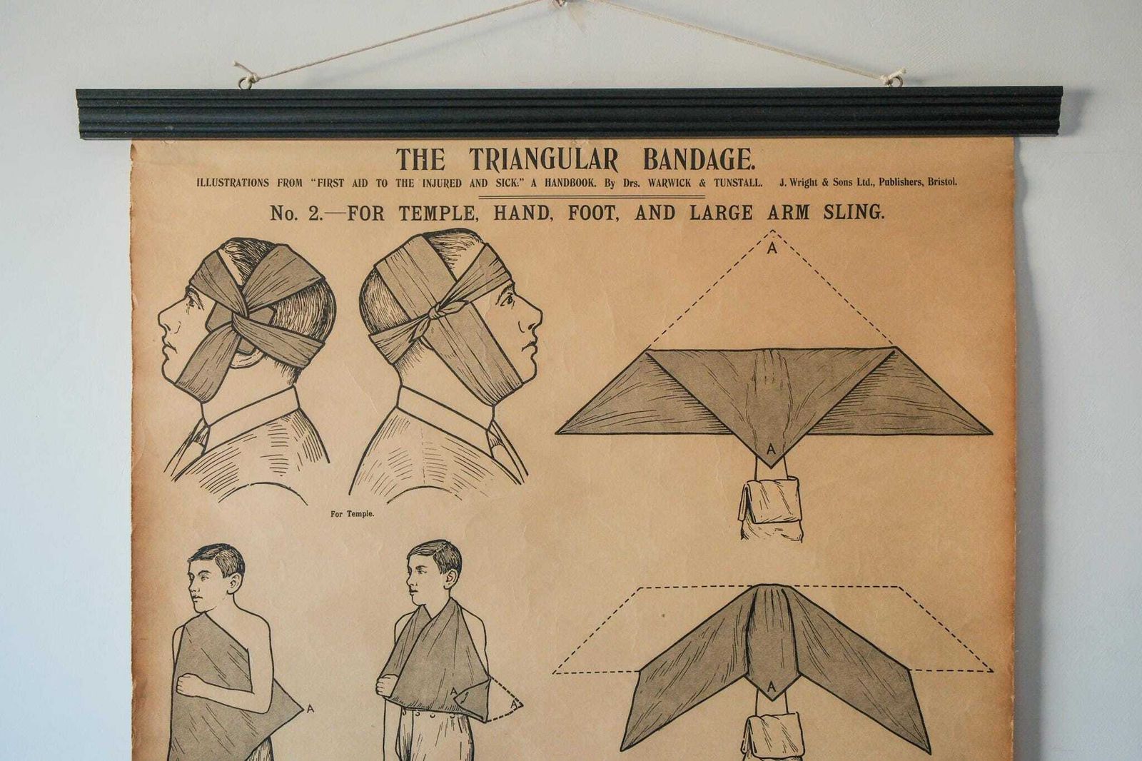 Original Anatomical Vintage British School Wall Chart Triangular Bandage Broken Bones Anatomy Wright & Sons First Aid Sling photo furniture
