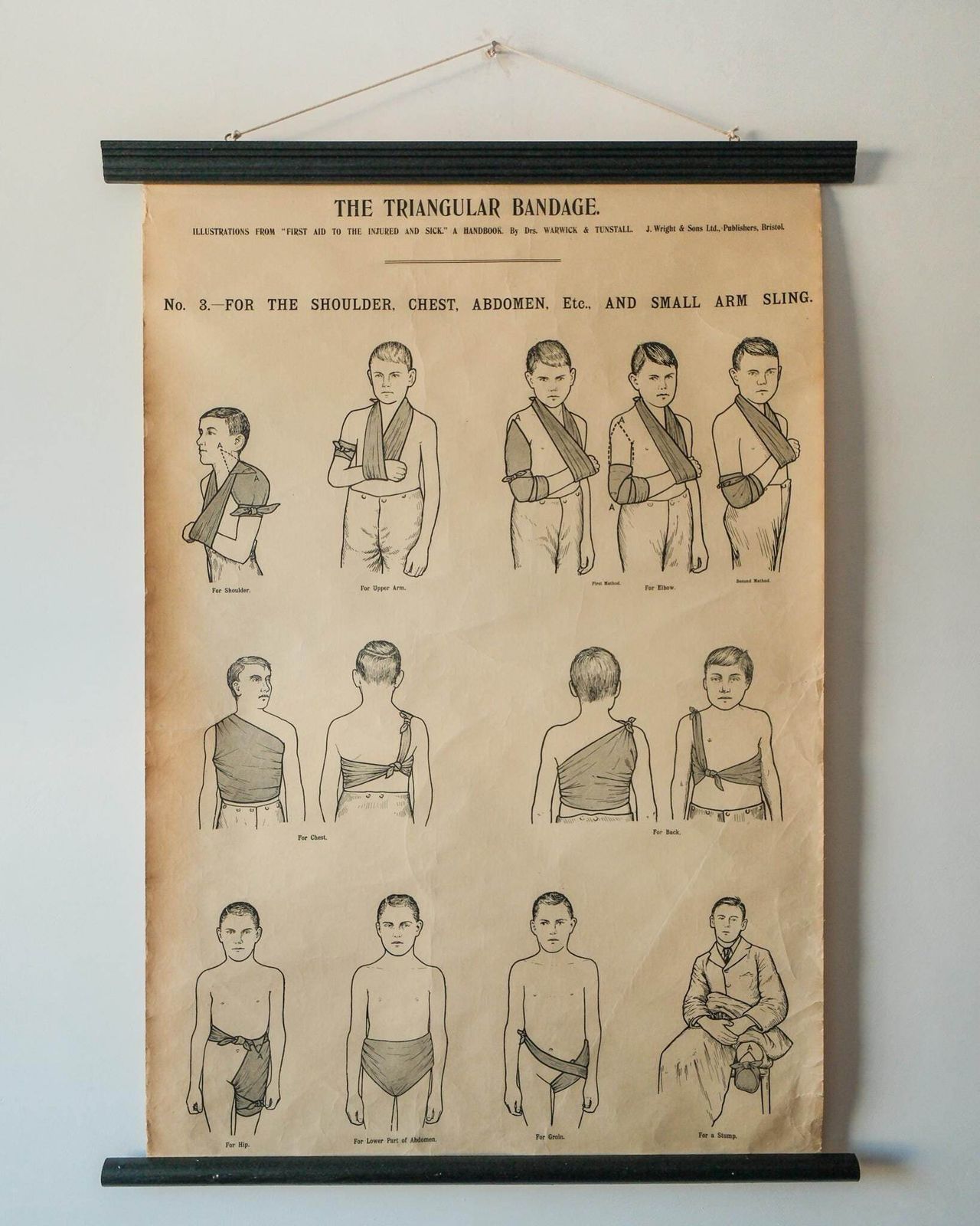 Original Anatomical Vintage British School Wall Chart Triangular Bandage Broken Bones Anatomy Wright & Sons First Aid Sling Arm Shoulder Hip