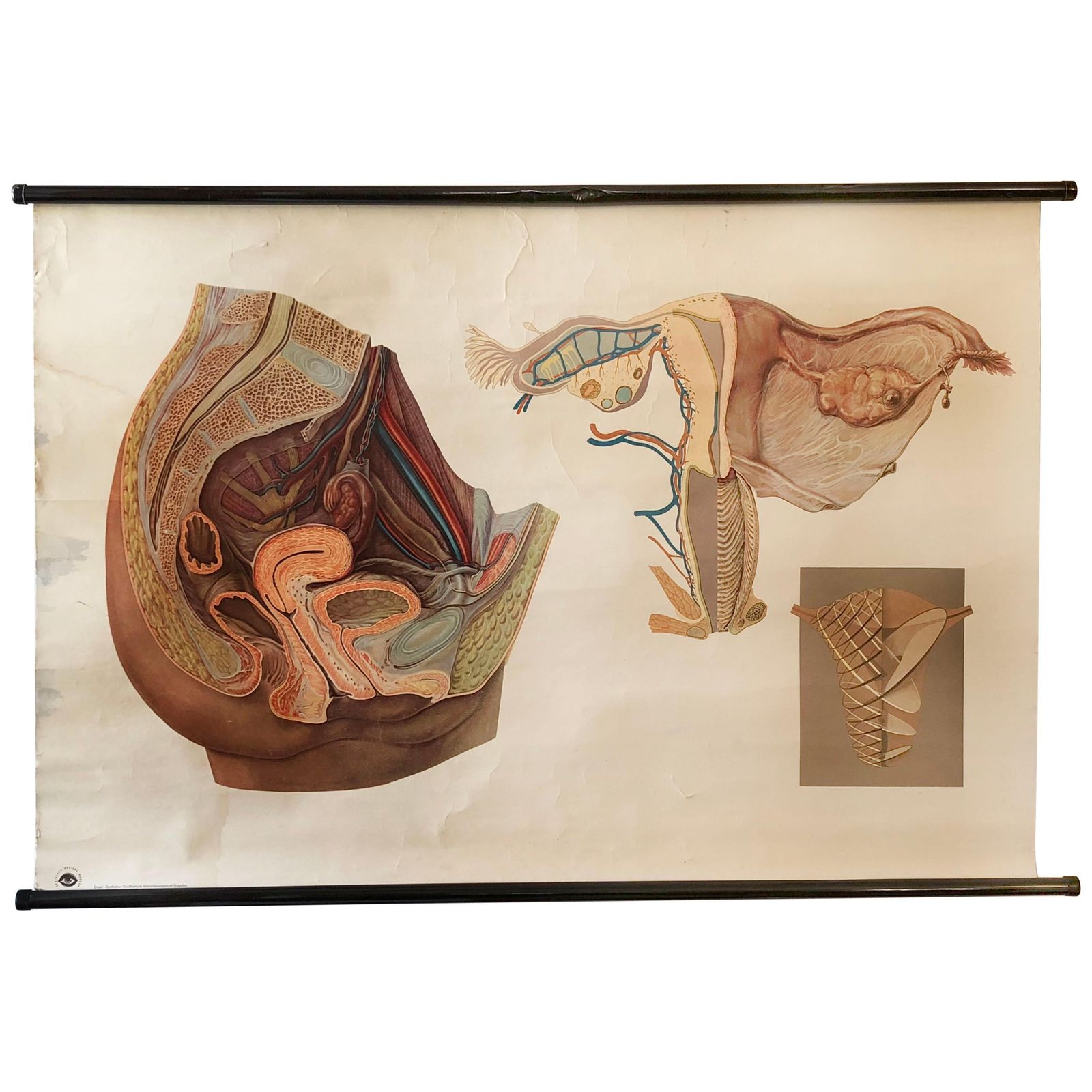 Antique Swedish School, Teaching Chart, Poster "Female Pelvic Organs"