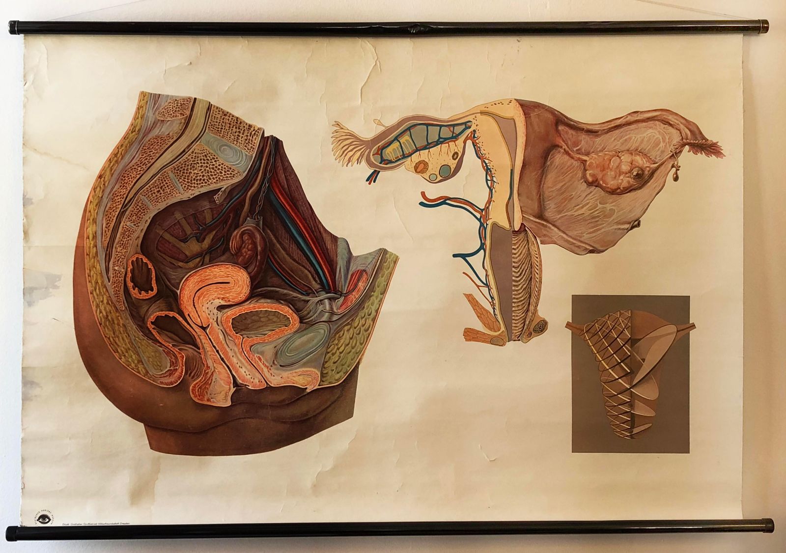 Antique Swedish School, Teaching Chart, Poster "Female Pelvic Organs" photo furniture