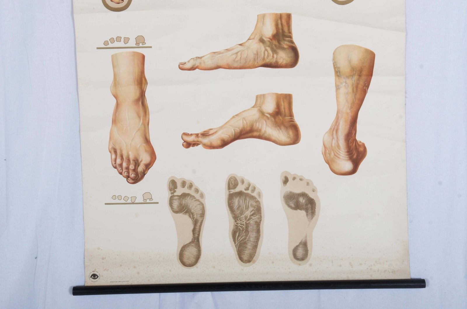 Vintage Groot Duits Medisch Schoolplaat, Poster "Orthopedics Of Foot" photo for sale