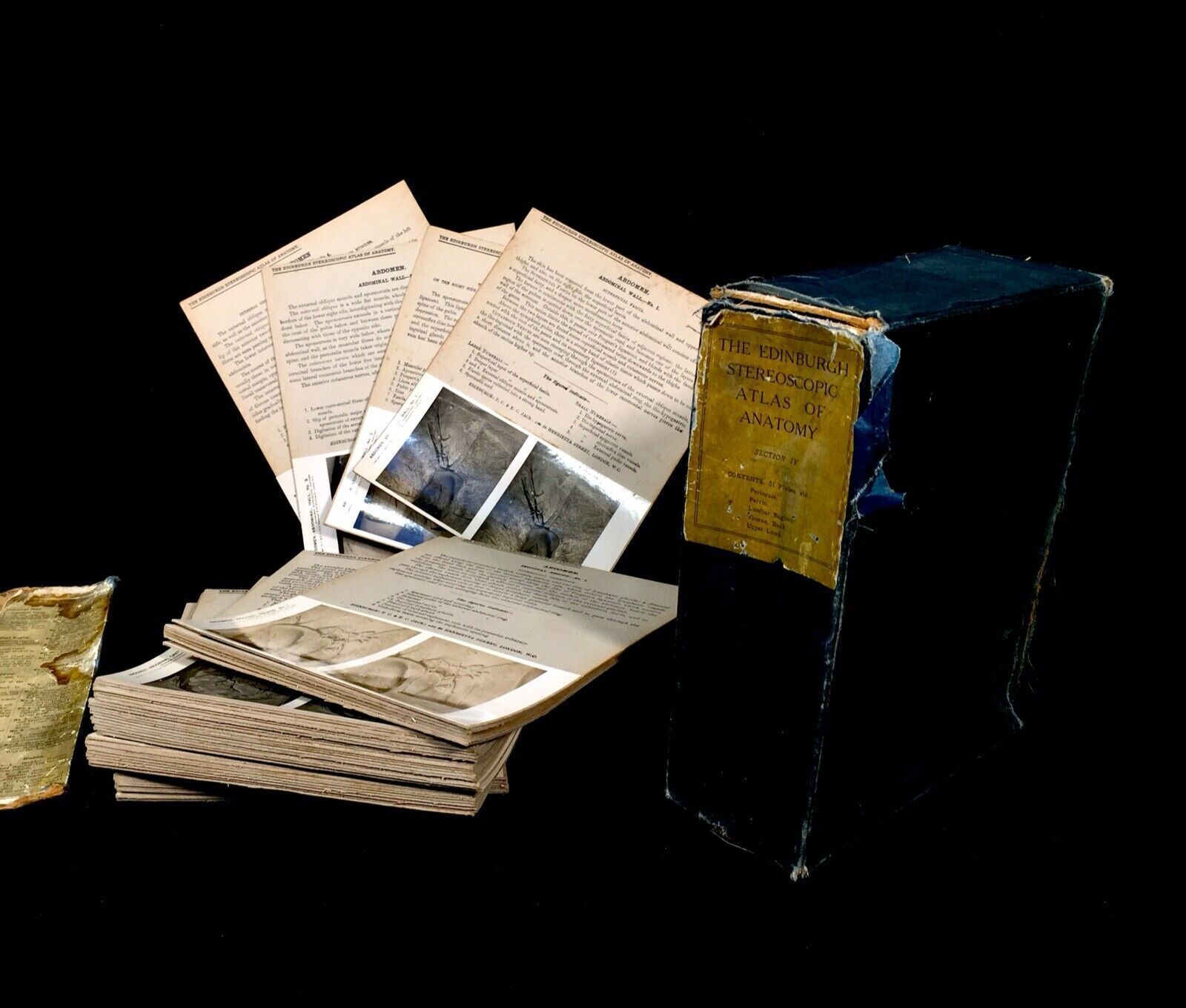 Antique Pair Of Boxed Edinburgh Stereoscopic Atlas Of Anatomy Cards Views C.1905 photo furniture