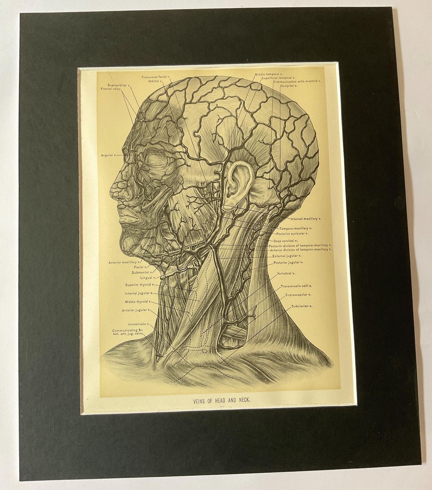 Antieke anatomische gravures uit 1900. Wanddecoratie. photo 95.0
