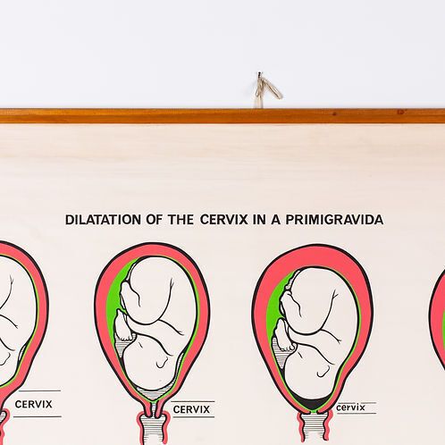 "Dilation Of The Cervix..." Adam Rouilly Medical Wall Chart photo for sale