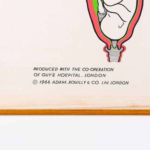 "Dilation Of The Cervix..." Adam Rouilly Medical Wall Chart photo 85.0
