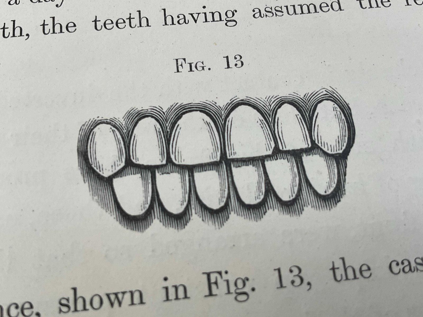 95.0 Antiek tandheelkundig boek uit 1870: Irregularities And Diseases Of The Teeth door Henry Sewill, Victoriaanse medische geschiedenis en tandheelkundige curiosa photo