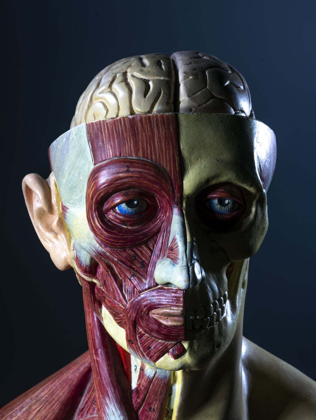 Anatomical Torso Model, Half Muscle Half Skin, Attributed To Deutsches Hygiene Museum Dresden, East Germany, 1950s photo for sale