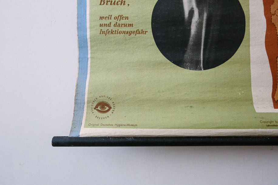 Original Anatomical Vintage German Educational School Wall Chart Bone Fractures Breaks Medicine Deutsches Science Museum Beautiful Rare photo 135.0