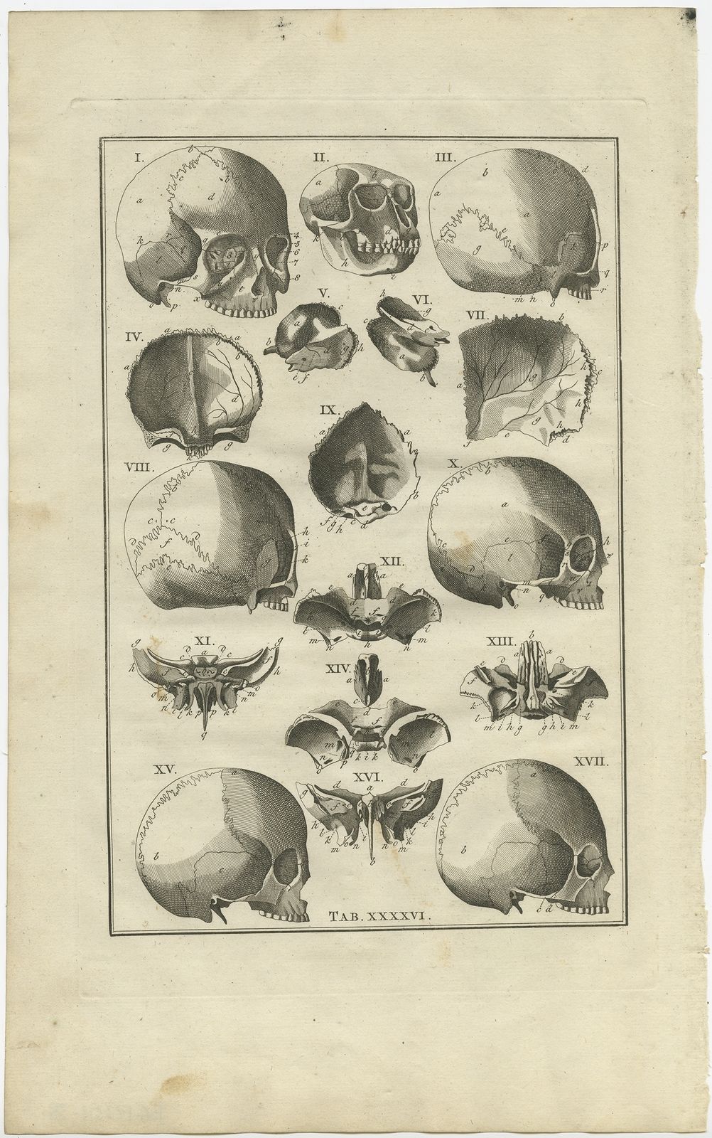 Pl. 46 Antique Anatomy Print Of The Head By Elwe (1798)