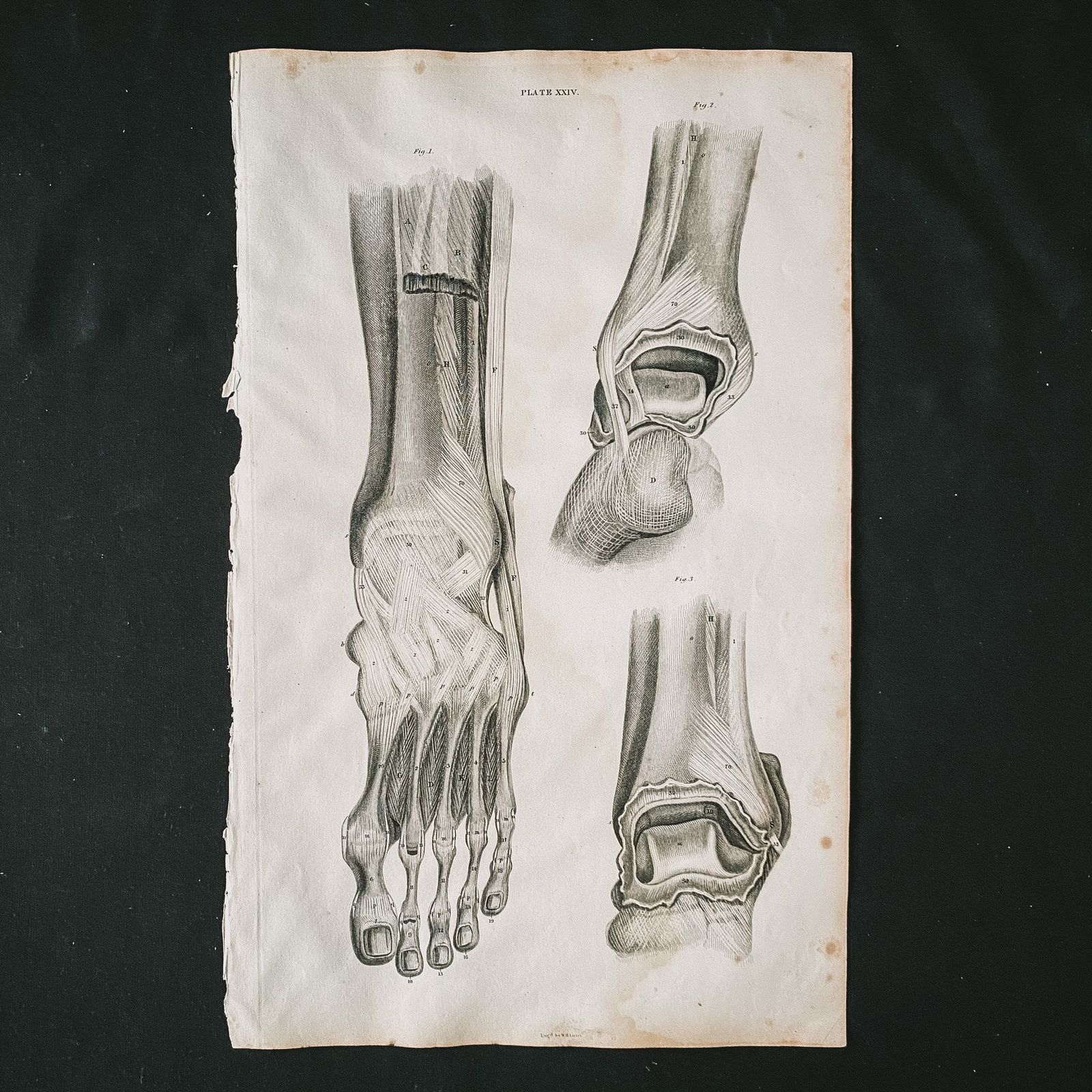 Anatomical Foot 1, Lizars 1824 'System Of Anatomical Plates' photo furniture