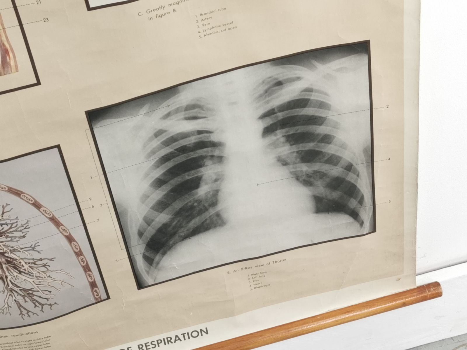 Respiratory Organ Medical Teaching Aid Poster By Adam Rouilly, 1940s. photo Art
