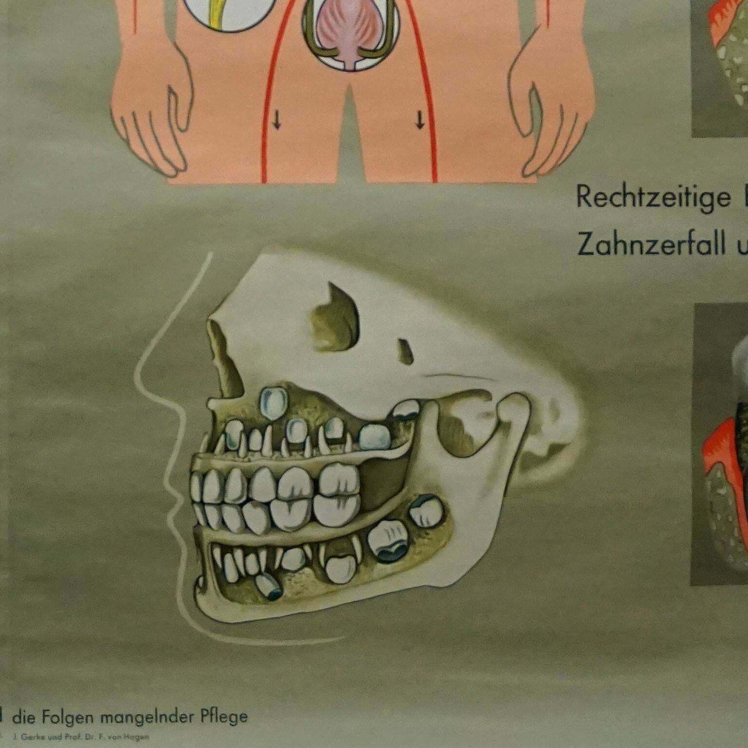 Human Body Poster Rollable Wall Chart Print Healthy Teeth Jaw Head photo vinterior